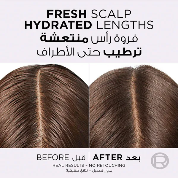 L'Oreal Paris Elvive Hyaluron Oil Erasing Scalp Serum 102 ml (4)