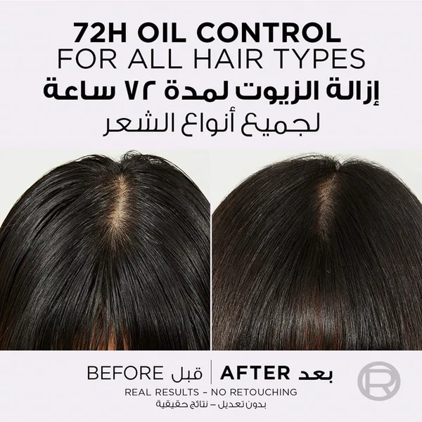 L'Oreal Paris Elvive Hyaluron Oil Erasing Scalp Serum 102 ml (5)