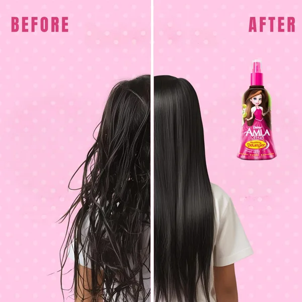 Dabur Amla Nourishing Kids Detangler Hair Oil with Olive & Almond 200 ml (4)