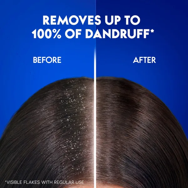 Head & Shoulders Charcoal Detox Anti-Dandruff Shampoo 400 ml (2)
